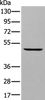 Western blot analysis of A431 cell  using DAPK2 Polyclonal Antibody at dilution of 1:400