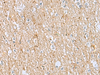 Immunohistochemistry of paraffin-embedded Human brain tissue  using LRRC49 Polyclonal Antibody at dilution of 1:40(×200)