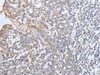 Immunohistochemistry of paraffin-embedded Human tonsil tissue  using GPD2 Polyclonal Antibody at dilution of 1:40(×200)