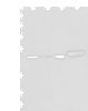 Western blot analysis of Hepg2 A431 Hela and A549 cell lysates  using PLAG1 Polyclonal Antibody at dilution of 1:250