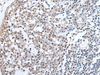 Immunohistochemistry of paraffin-embedded Human tonsil tissue  using PLAG1 Polyclonal Antibody at dilution of 1:25(×200)