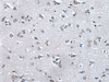 Immunohistochemistry of paraffin-embedded Human brain tissue  using HAND1 Polyclonal Antibody at dilution of 1:30(×200)