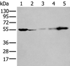 Western blot analysis of 293T A549 A431 Hela and Jurkat cell lysates  using PFKFB3 Polyclonal Antibody at dilution of 1:400