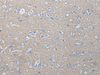 Immunohistochemistry of paraffin-embedded Human brain tissue  using ETFB Polyclonal Antibody at dilution of 1:40(×200)