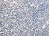 Immunohistochemistry of paraffin-embedded Human tonsil tissue  using ZBTB10 Polyclonal Antibody at dilution of 1:100(×200)