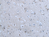 Immunohistochemistry of paraffin-embedded Human brain tissue  using ZNF703 Polyclonal Antibody at dilution of 1:55(×200)