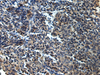 Immunohistochemistry of paraffin-embedded Human tonsil tissue  using ATP1B2 Polyclonal Antibody at dilution of 1:25(×200)