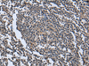 Immunohistochemistry of paraffin-embedded Human tonsil tissue  using WNT9B Polyclonal Antibody at dilution of 1:85(×200)