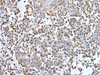 Immunohistochemistry of paraffin-embedded Human tonsil tissue  using UBN1 Polyclonal Antibody at dilution of 1:130(×200)