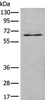 Western blot analysis of SKOV3 cell lysate  using UBQLN2 Polyclonal Antibody at dilution of 1:500
