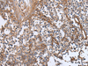 Immunohistochemistry of paraffin-embedded Human tonsil tissue  using BLVRB Polyclonal Antibody at dilution of 1:65(×200)