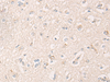 Immunohistochemistry of paraffin-embedded Human brain tissue  using IBA57 Polyclonal Antibody at dilution of 1:65(×200)