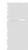 Western blot analysis of Human fetal intestines tissue and Human breast cancer tissue lysates  using CCDC85C Polyclonal Antibody at dilution of 1:400