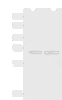 Western blot analysis of Human cerebella tissue Human cerebrum tissue lysates  using FNBP1L Polyclonal Antibody at dilution of 1:750