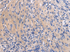 Immunohistochemistry of paraffin-embedded Human brain tissue  using GALR3 Polyclonal Antibody at dilution of 1:50(×200)