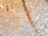 Immunohistochemistry of paraffin-embedded Human tonsil tissue  using GPR162 Polyclonal Antibody at dilution of 1:65(×200)