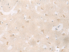 Immunohistochemistry of paraffin-embedded Human brain tissue  using GPR83 Polyclonal Antibody at dilution of 1:60(×200)