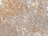 Immunohistochemistry of paraffin-embedded Human tonsil tissue  using RAPGEF1 Polyclonal Antibody at dilution of 1:45(×200)