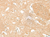 Immunohistochemistry of paraffin-embedded Human brain tissue  using HPCA Polyclonal Antibody at dilution of 1:55(×200)