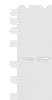 Western blot analysis of A172 and LO2 cell lysates  using HNRNPA3 Polyclonal Antibody at dilution of 1:500