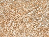 Immunohistochemistry of paraffin-embedded Human tonsil tissue  using HNRNPA3 Polyclonal Antibody at dilution of 1:45(×200)