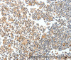 Immunohistochemistry of paraffin-embedded Human tonsil tissue using SPDEF Polyclonal Antibody at dilution 1:60