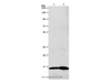 Western Blot analysis of 293T cell and Human fetal brain tissue using LHB Polyclonal Antibody at dilution of 1:800