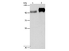 Western Blot analysis of Huvec cell and Human placenta tissue using CD61 Polyclonal Antibody at dilution of 1:500