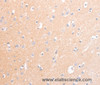 Immunohistochemistry of paraffin-embedded Human brain tissue using CD56 Polyclonal Antibody at dilution 1:30
