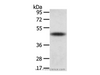 Western Blot analysis of Mouse adrenal gland tissue using TTC23 Polyclonal Antibody at dilution of 1/800