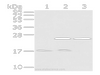 Western Blot analysis of Human fetal brain tissue, Hela and 293T cells using PDPN Polyclonal Antibody at dilution of 1/200