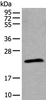 Western blot analysis of Jurkat cell lysate  using TPT1 Polyclonal Antibody at dilution of 1:800
