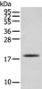 Western blot analysis of Mouse skeletal muscle tissue  using TNNC1 Polyclonal Antibody at dilution of 1:250
