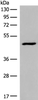 Western blot analysis of HL-60 cell lysate  using DCP2 Polyclonal Antibody at dilution of 1:500