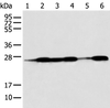 Western blot analysis of Human fetal muscle tissue HEPG2 Jurkat Hela A431 and A549 cell  using BAG2 Polyclonal Antibody at dilution of 1:550
