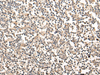 Immunohistochemistry of paraffin-embedded Human tonsil tissue  using MAGEA1 Polyclonal Antibody at dilution of 1:65(×200)