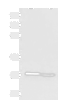 Western blot analysis of Human fetal intestines tissue and Human fetal liver tissue lysates  using KLRB1 Polyclonal Antibody at dilution of 1:800