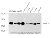 Western Blot analysis of various samples using Histone H3 Polyclonal Antibody at dilution of 1:1000.