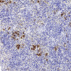 Immunohistochemistry analysis of paraffin-embedded Rat inflammatory spleen  using ITGAX Polyclonal Antibody at dilution of 1:200.