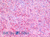 Immunohistochemistry analysis of paraffin-embedded Human Spleen using ITGAX Polyclonal Antibody(Elabscience® Product Detected by Lifespan).