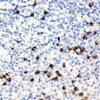 Immunohistochemistry analysis of paraffin-embedded Human tonsil  using CD19 Polyclonal Antibody at dilution of 1:300.