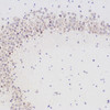 Immunohistochemistry analysis of paraffin-embedded mouse brain  using CHAT Polyclonal Antibody at dilution of 1:300.