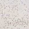 Immunohistochemistry analysis of paraffin-embedded Rat brain  using CHAT Polyclonal Antibody at dilution of 1:100.