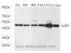 Western Blot analysis of various samples using GAP43 Polyclonal Antibody at dilution of 1:2000.