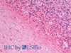 Immunohistochemistry analysis of paraffin-embedded Human Cerebellum using GAP43 Polyclonal Antibody(Elabscience® Product Detected by Lifespan).