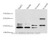 Western Blot analysis of various kidney using LC3A/B Polyclonal Antibody at dilution of 1:1000.