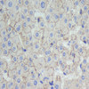 Immunohistochemistry analysis of paraffin-embedded human liver  using N-cadherin Polyclonal Antibody at dilution of 1:500.