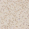 Immunohistochemistry analysis of paraffin-embedded rat brain  using Tau Polyclonal Antibody at dilution of 1:100.