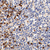 Immunohistochemistry analysis of paraffin-embedded Human tonsil  using Cyclin B1 Polyclonal Antibody at dilution of 1:300.