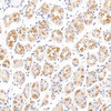 Immunohistochemistry analysis of paraffin-embedded human stomach  using CXCR7 Polyclonal Antibody at dilution of 1:100.